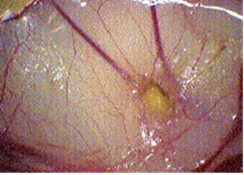 Fig. 2 PGM 200ug/CAM +0.5